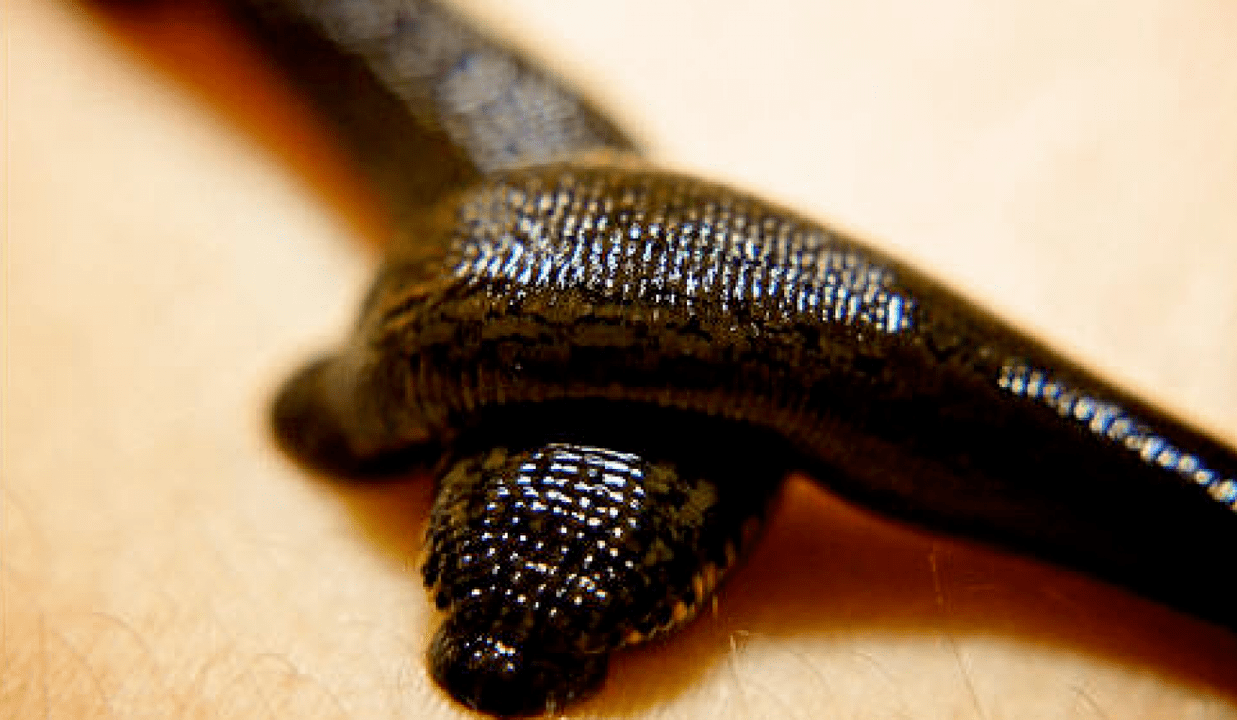 prostatitisaren tratamendurako leeches